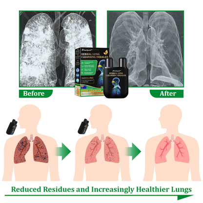 🎉✅Official Store:Ourlyard™ Herbal Lung Cleansing Inhaler (💝 Cough, wheezing, shortness of breath, sputum, stuffy nose, bronchitis, bronchitis, allergy symptoms, lung discomfort💝)
